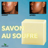 Le savon au soufre 